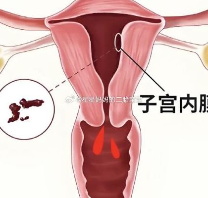 子宫内膜厚可以做试管婴儿吗_先看厚度和病因再定方案
