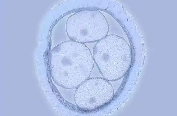 试管移植两个胚胎有可能怀龙凤胎