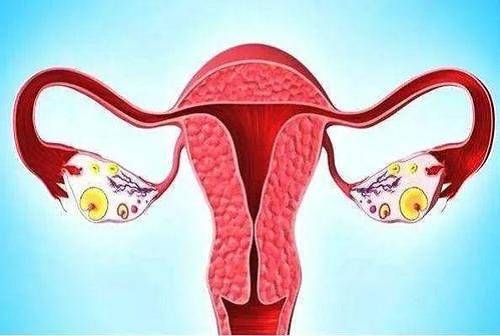 患有子宫内膜息肉的妇女可不可以做试管婴儿？