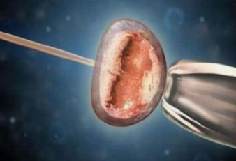 鲜胚移植成功率有多高 什么条件适合移植鲜胚