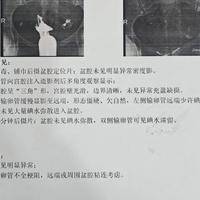 输卵管堵塞跟男人有关系么？34岁小周的经历值得备孕夫妻看看