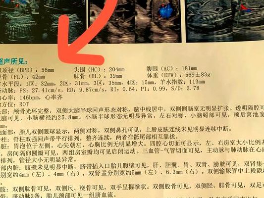 四维单子3秒钟看男是女？超声科医生忍了十年终于说出大实话