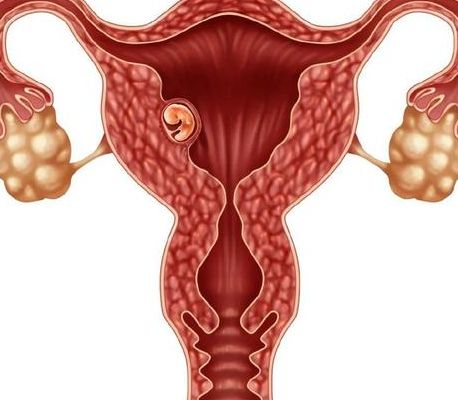 试管哪些人不需要降调？这三类女性可直接进周