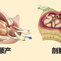头盆不称顺产几率有多大?胎儿体重是决定的关键