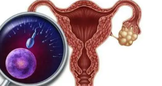治疗多囊卵巢的方法试管有用吗？