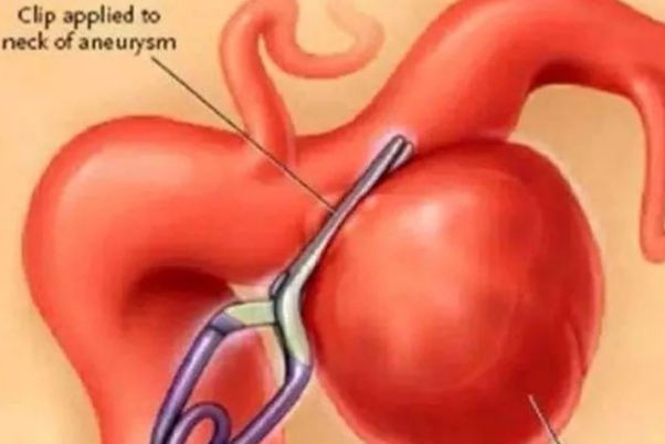 切除子宫寿命减少十五年?医学数据给出明确答案