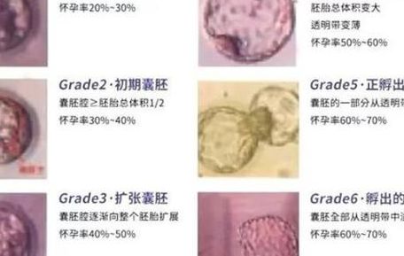 试管鲜胚和囊胚第几天能测出来？过来人帮你梳理全部费用开销