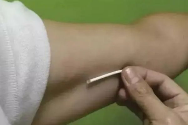 请问皮埋避孕和上环哪个避孕效果好且时间长？