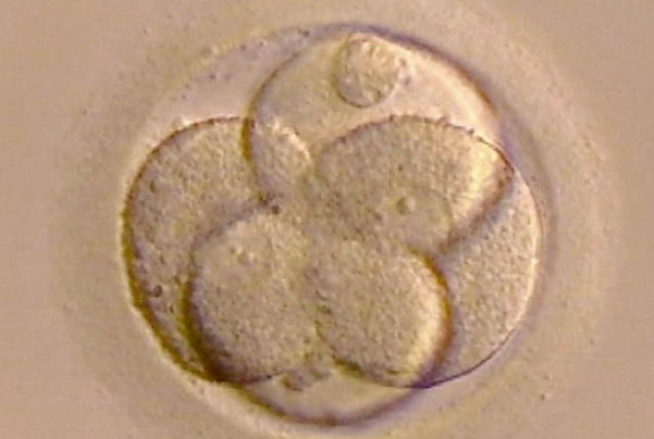 囊胚移植的成功率受胚胎质量影响