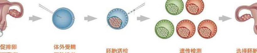 做试管能不能选择男女：国内严禁PK海外部分允许