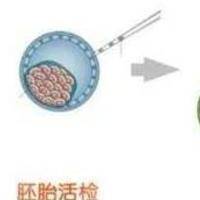 做试管能不能选择男女：国内严禁PK海外部分允许