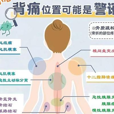 女性后背疼警惕四种病，我差点把心梗当成腰肌劳损