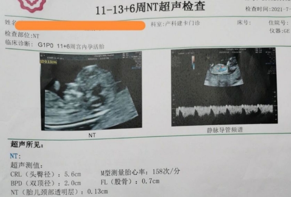 nt临近界值可能正常也可能不正常
