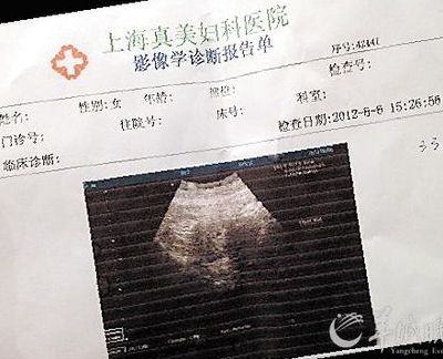 早孕b超单子看男孩女孩诀窍:B超医生不会明说的三个真相