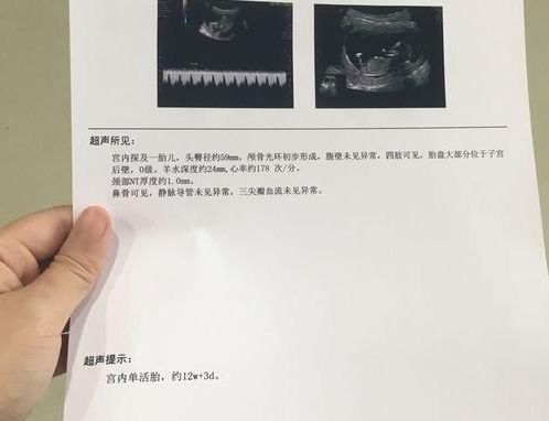34岁的小周备孕两年，终于承认：要孩子，等不起
