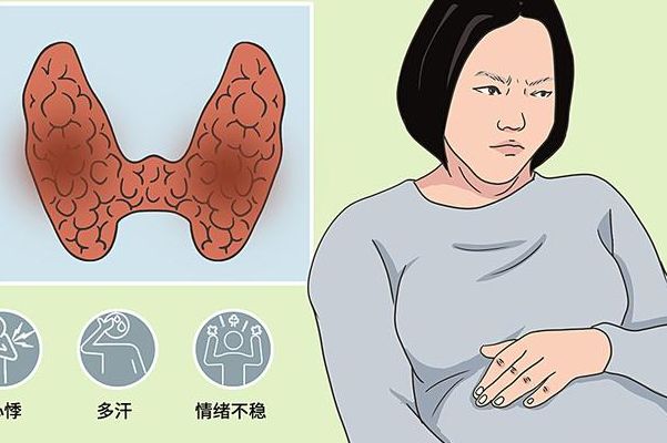 孕妇甲亢会影响胎儿吗？疾病放任不管的代价，远比药物副作用更难承受