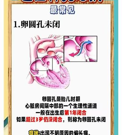 卵圆孔未闭症状和危害真不能大意，我的试管宝宝这样熬过来