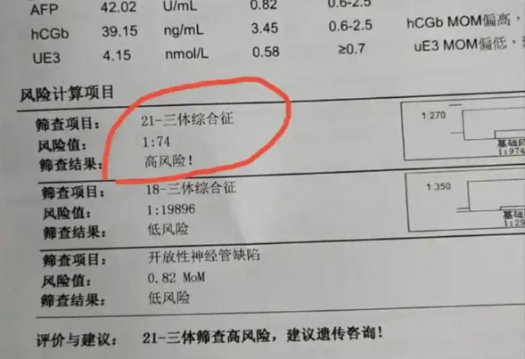 唐氏筛查报告高风险要进一步做检查