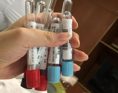 阿托西班保胎一个疗程用几支？按48小时算常在10支上下