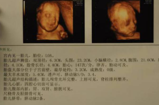 茄子型是怀男孩