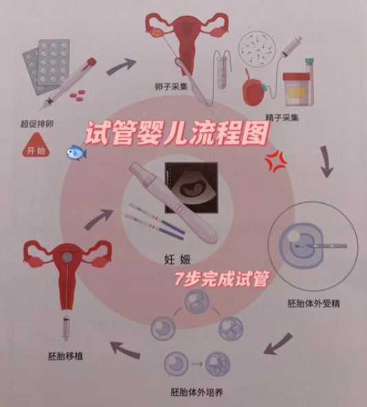 试管婴儿流程步骤 试管婴儿流程步骤