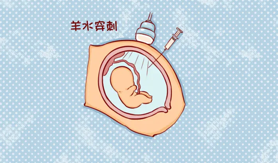 做羊水穿刺的费用是多少    什么时候做羊水穿刺最准确