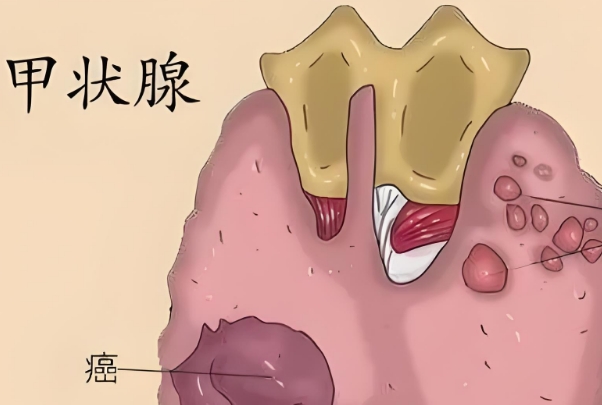 甲状腺功能会影响妊娠健康