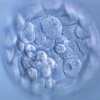 试管婴儿最好的囊胚是4bb级别的吗？