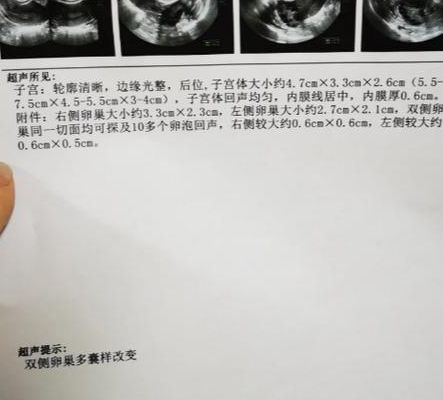 卵泡不发育是什么原因：激素信号紊乱PK卵巢自身衰竭