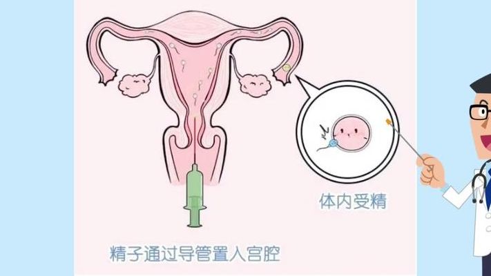 两个女生可以试管怀孕吗？先弄清和法律这两关