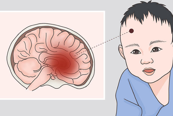保胎下来的孩子智力受影响吗?科学视角下的真相剖析
