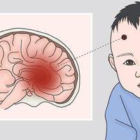 保胎下来的孩子智力受影响吗?科学视角下的真相剖析