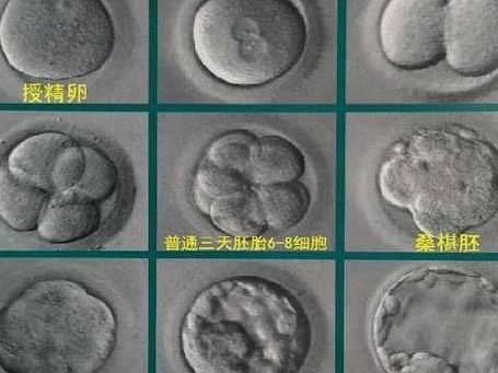 试管鲜胚和囊胚的区别：不是晚两天那么简单