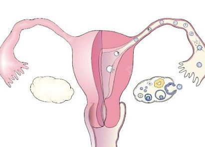 子宫次全切术影响卵巢血供吗
