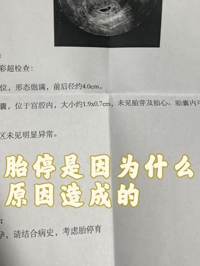 为什么试管的胎停的多？三个真实原因别忽略