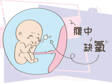胎儿缺氧的3大症状，胎儿缺氧和体外受精有关系吗