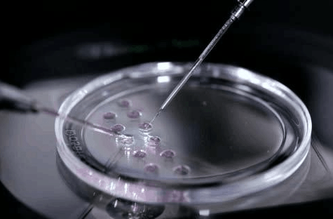 卵子取出后在实验室里受精