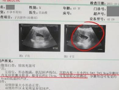 腺肌症试管难成功吗_三次移植都失败了,5个判断维度帮你破局