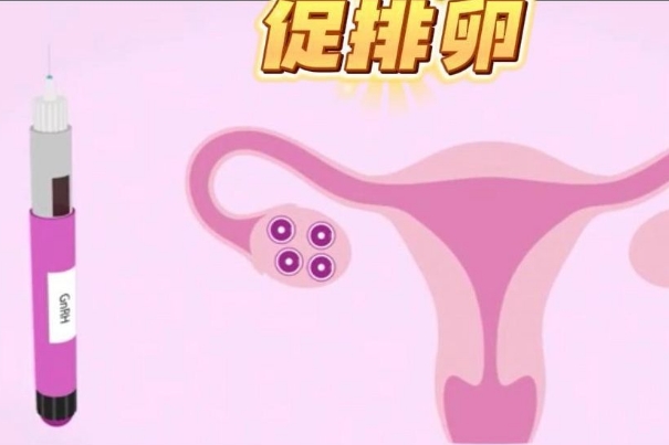 备孕和试管促排的用药有差异