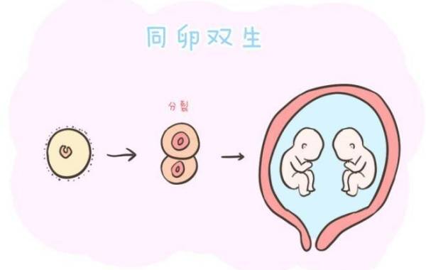 二代试管怀的双胞胎同卵和异卵在外貌上的区别大