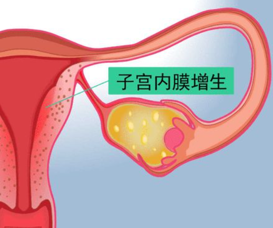 内膜状态影响胚胎着床