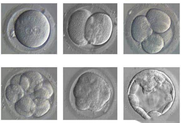 教你看懂影响试管成功的重要因素，胚胎等级是如何划分的？