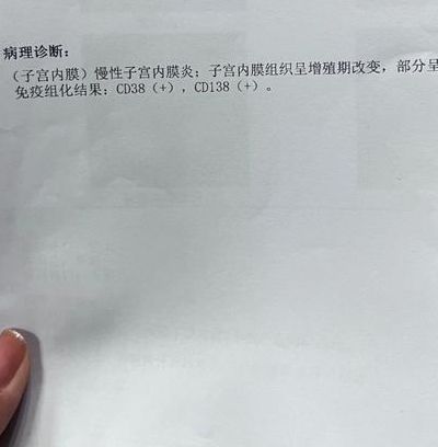 cd138阳性是什么意思会不孕吗：直接判不孕PK先分清炎症真假