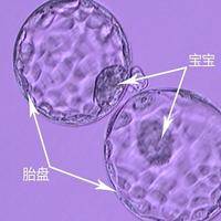囊胚移植两颗5AA囊胚?双胞胎概率与风险参考