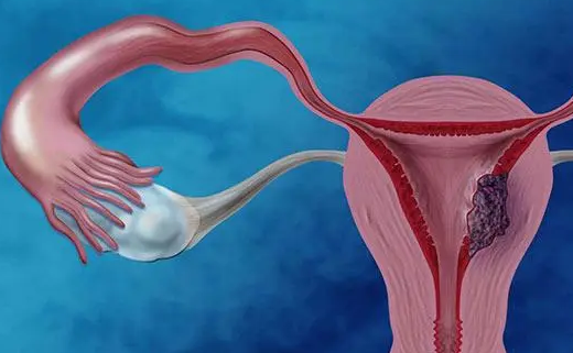 子宫内膜厚度影响到胚胎的着床