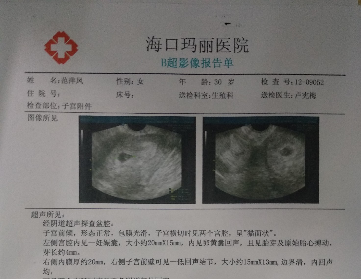 d384c044-2ac3-4912-a4d2-34023215cd8d