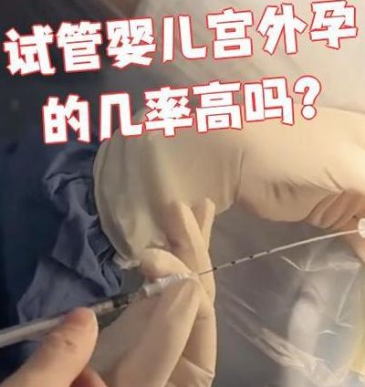 试管的宫外孕几率大吗？自然受孕低风险PK试管隐患，数据说了算