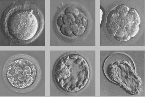 遗传差异导致胚胎形态差异大