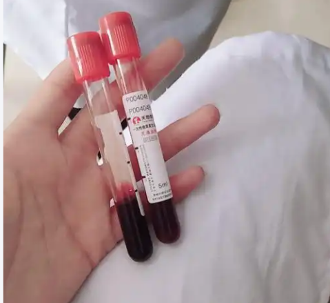 孕初期抽血验男女准确率低