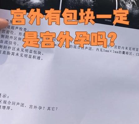 宫外怀孕的症状，4个判断维度能救命